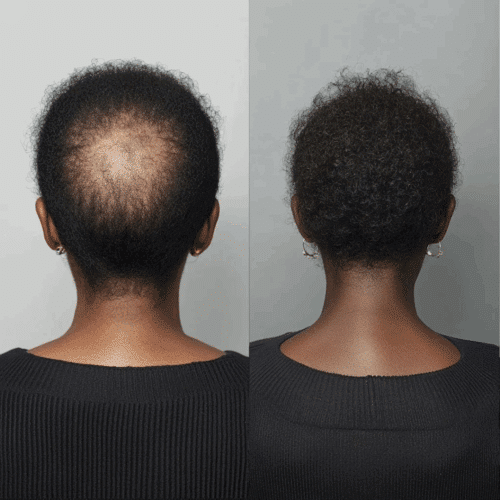 Follicle Activator 3.0 Benefits