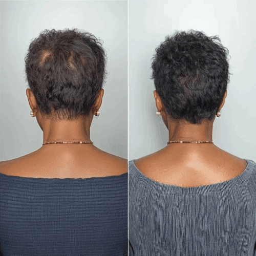 Follicle Activator 3.0 (official Retailer) 2025